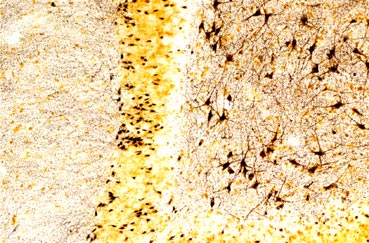 Detection of degenerating neurons in the rat hippocampus of an epilepsy model with FD NeuroSilver&trade; Kit II