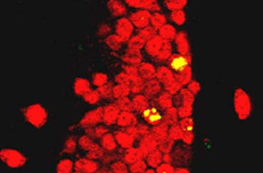 Confocal image of BrdU & NeuN double-labeled granule cells in the mouse dentate gyrus